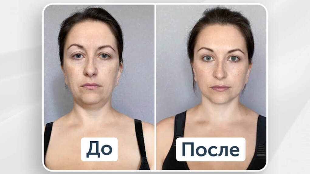 Ревиботик